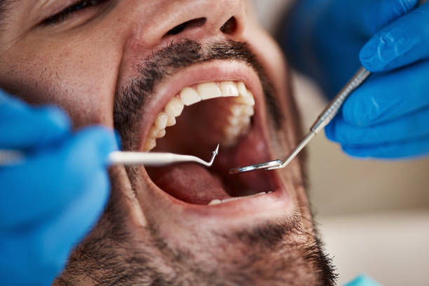 Best Emergency TMJ Treatment in Bement, IL
