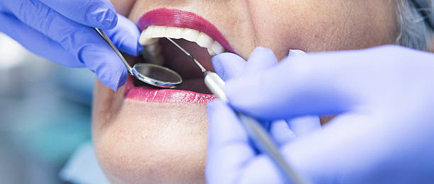 Best Emergency Gum Treatment in Bement, IL